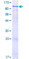 12.5% SDS-PAGE Stained with Coomassie Blue.